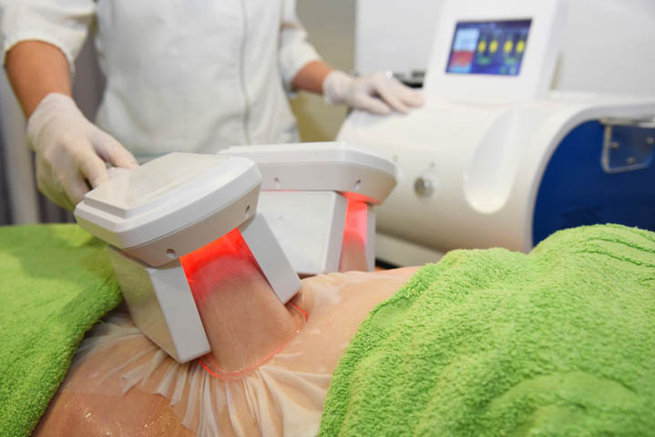 Cryolipolysis